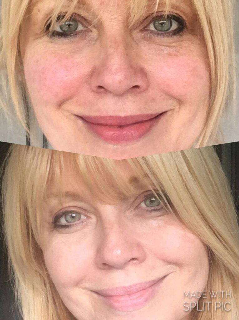REVIVE COMCIT BEFORE AND AFTER 2 CHRISTINE - Revive Beauty & Tanning